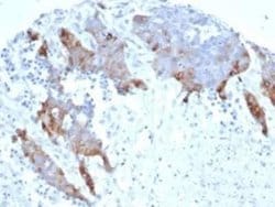 Transglutaminase 2/TGM2 Rabbit anti-Human, Clone: TGM2/6943R, Novus Biologicals 100 &mu;g | Buy Online | Novus Biologicals | Fisher Scientific